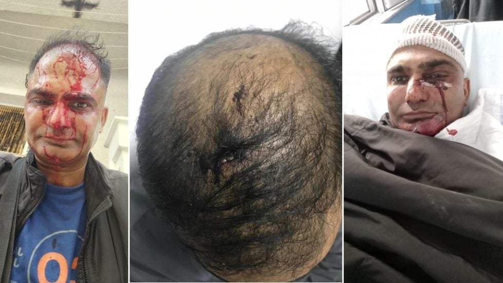 Ο διανομέας Μοχάμεντ Ασλάμ που χτυπήθηκε βίαια από ρατσιστές στα Σεπόλια